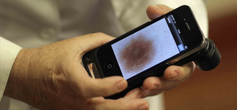  DIAGNOSIS NOW POSSIBLE WITH SMARTPHONE