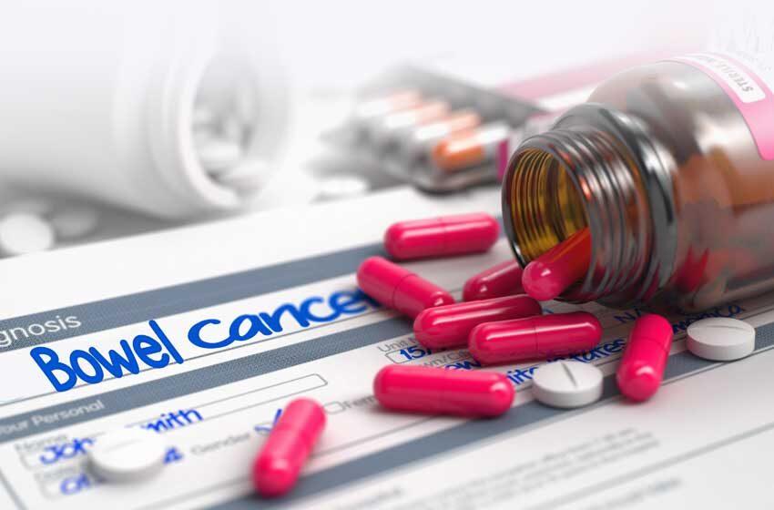  Bowel Cancer Pill Subsidised to $6 from $33000 by Australian Government